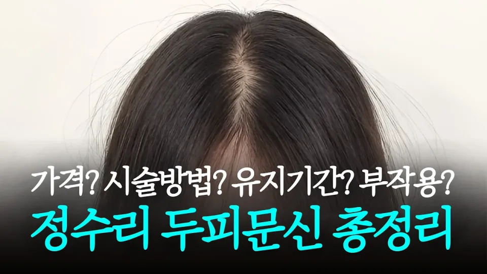 정수리 두피문신 어떤 점이 중요한지 가격 부작용 유지기간 시술방식을 중심으로